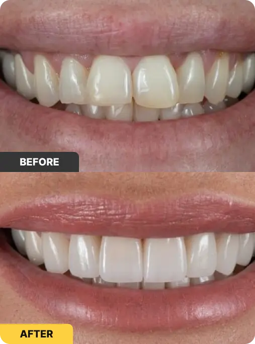 district - before after 3