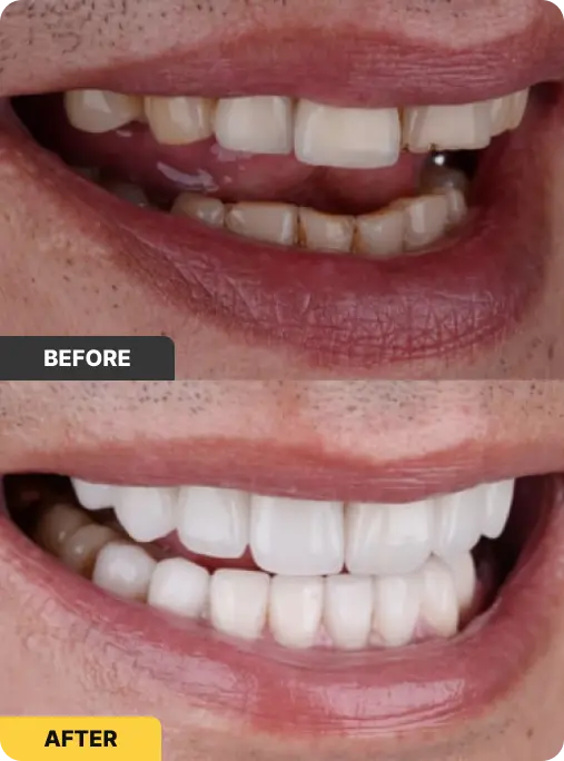 district - before after 4